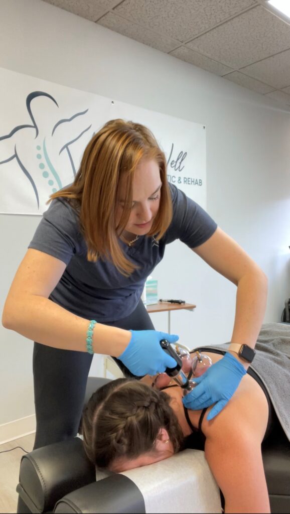 A picture of a patient receiving cupping therapy.
